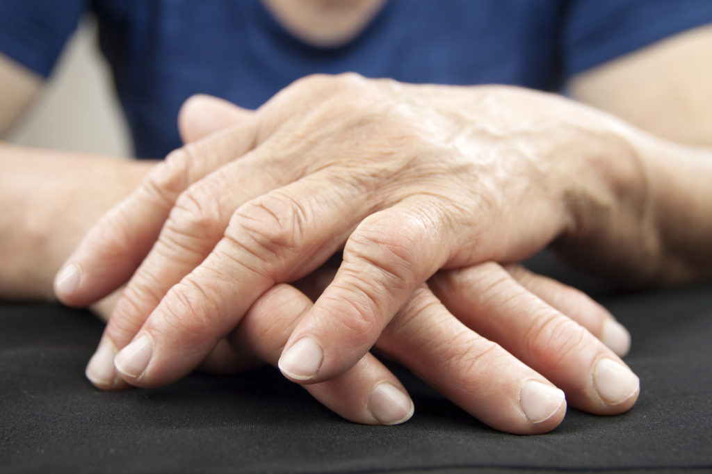 Arthritis Pain & Hand Therapy Layton UT wasatch peak physical therapy